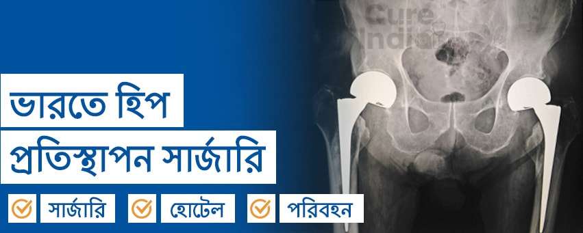 হিপ রিপ্লেসমেন্ট